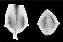 マンモグラフィ読影に最適化された画像ビューア