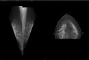 マンモグラフィ読影に最適化された画像ビューア